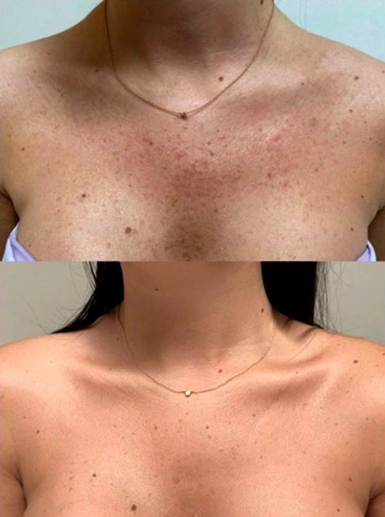 Manusa Exfolianta - MANUSA EXFOLIANTA (matase 100% Naturala, Non-abraziva)