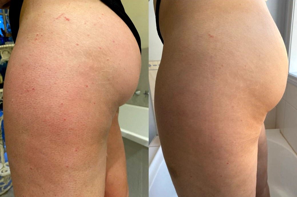 Manusa Exfolianta - MANUSA EXFOLIANTA (matase 100% Naturala, Non-abraziva)